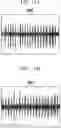 Fig. 14 - SYSTEM AND METHOD FOR DETECTING SOUND IN VEHICLE