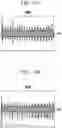 Fig. 18 - SYSTEM AND METHOD FOR DETECTING SOUND IN VEHICLE