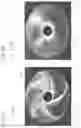 Fig. 03 - DIAPHRAGM OR DUST CAP AND SPEAKER UNIT