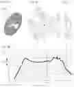 Fig. 05 - DIAPHRAGM OR DUST CAP AND SPEAKER UNIT