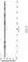 Fig. 14 - RADIO INTERFERENCE MEASUREMENT