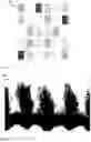 Fig. 07 - Crop scanner