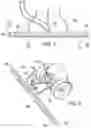 Fig. 04 - Harvest vacuum assembly