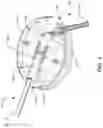 Fig. 05 - Pest resistant birdfeeder