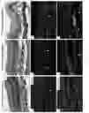 Fig. 15 - Cryopreservation of cell-seeded substrates and related methods