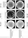 Fig. 15 - ALTERING MICROBIAL POPULATIONS & MODIFYING MICROBIOTA