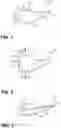 Fig. 02 - Inflation needle holder
