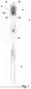 Fig. 02 - Head for an oral-care implement and a kit comprising such head