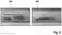 Fig. 09 - Head for an oral-care implement and a kit comprising such head