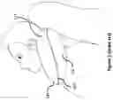 Fig. 03 - Inflatable pillow