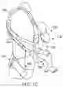 Fig. 03 - Child carrier