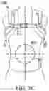 Fig. 10 - Child carrier