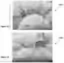 Fig. 03 - Adjustable Pillows and Methods of Manufacturing Same