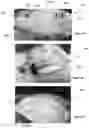 Fig. 08 - Adjustable Pillows and Methods of Manufacturing Same