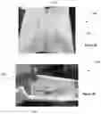 Fig. 09 - Adjustable Pillows and Methods of Manufacturing Same