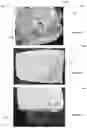 Fig. 11 - Adjustable Pillows and Methods of Manufacturing Same