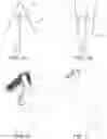 Fig. 02 - Ornament display hanger