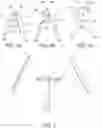Fig. 03 - Ornament display hanger