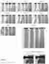 Fig. 07 - INTERLOCKING RING CURTAIN LINER AND CURTAIN SYSTEMS THEREOF