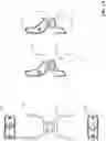 Fig. 15 - Apparatus for dental irrigation