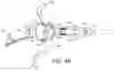 Fig. 06 - Portable endoscope with disposable steerable cannula