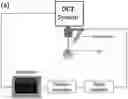 Fig. 01 - Optical coherence elastography to assess biomechanics and detect progression of ocular and other tissues degenerative diseases