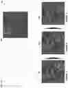 Fig. 07 - Systems, methods, and devices for optical coherence tomography multiple enface angiography averaging