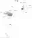 Fig. 09 - Ophthalmologic microscope and function expansion unit