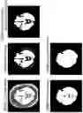 Fig. 10 - Magnetic resonance imaging apparatus, image processor, and image processing method