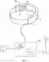 Fig. 02 - APPARATUS AND METHOD FOR DIAGNOSING VESSEL OCCLUSION