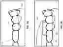 Fig. 03 - Methods and systems for imaging orthodontic aligners