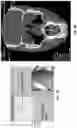 Fig. 05 - Methods and systems for imaging orthodontic aligners