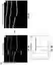 Fig. 07 - Methods and systems for imaging orthodontic aligners