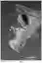 Fig. 08 - Methods and systems for imaging orthodontic aligners