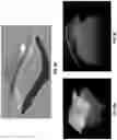 Fig. 10 - Methods and systems for imaging orthodontic aligners