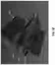 Fig. 19 - Methods and systems for imaging orthodontic aligners
