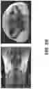 Fig. 05 - SYSTEM, METHOD AND COMPUTER-ACCESSIBLE MEDIUM FOR DETERMINING A MAGNETIC RESONANCE IMAGING TEMPERATURE PROFILE