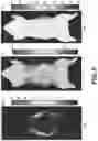 Fig. 09 - SYSTEM, METHOD AND COMPUTER-ACCESSIBLE MEDIUM FOR DETERMINING A MAGNETIC RESONANCE IMAGING TEMPERATURE PROFILE