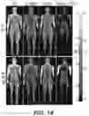 Fig. 18 - SYSTEM, METHOD AND COMPUTER-ACCESSIBLE MEDIUM FOR DETERMINING A MAGNETIC RESONANCE IMAGING TEMPERATURE PROFILE