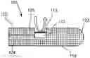 Fig. 01 - DEVICES AND METHODS FOR MEASURING PORTAL PRESSURE
