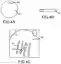 Fig. 05 - System and method for displaying electrophysiological signals from multi-dimensional catheters