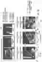 Fig. 13 - Rapid quantitative evaluations of heart function with strain measurements from strain encoded MRI