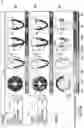 Fig. 15 - Rapid quantitative evaluations of heart function with strain measurements from strain encoded MRI