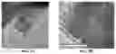 Fig. 03 - Low cost diabetes breath analyzer based on nanostructured KWOmaterial