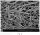 Fig. 09 - Low cost diabetes breath analyzer based on nanostructured KWOmaterial