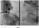 Fig. 20 - Low cost diabetes breath analyzer based on nanostructured KWOmaterial