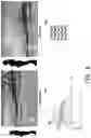 Fig. 09 - Smart strap and method for defining human posture