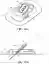 Fig. 19 - ANALYTE SENSOR
