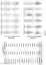 Fig. 34 - Method and a system for analyzing neuropharmacology of a drug