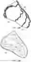 Fig. 18 - Creating a vascular tree model